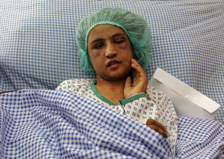 Police Initially Sent Afghan Girl Back to her Torturers